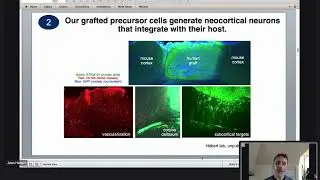 Dr. Jean Hebert: Progressive Brain Tissue Replacement and How we Beat Aging!