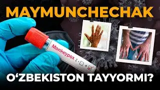 MAYMUNCHECHAK. O'ZBEKISTON TAYYORMI?