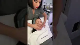 Nano-needling gave me SUCH ✨glassy✨ skin 😱