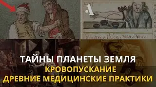 Тайны планеты  Земля.  Кровопускание. Древние медицинские практики. Интересные факты