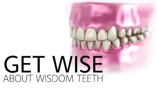 Get Wise About Wisdom Teeth