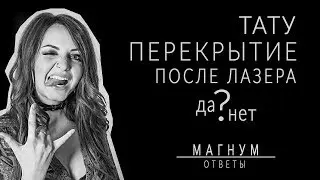 Лазерное удаление ТАТУ перед перекрытием «Магнум тату. Ответы» выпуск 5