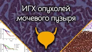 ДЕМО ИГХ опухолей мочевого пузыря | Лекции по патологической анатомии