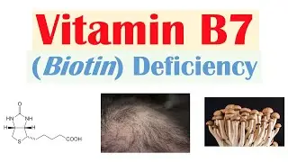 Vitamin B7 Biotin Deficiency | Sources, Purposes, Causes, Symptoms, Diagnosis, Treatment