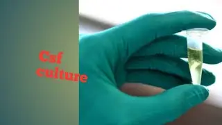 CSF culture test procedure microbiology