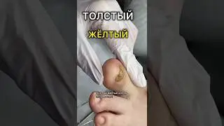 ЧЕМ СПИЛИТЬ? #аленалаврентьева #shortsvideo #подолог #подология #обучениеподологии #doctoralex