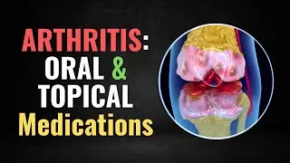 Which Oral & Topical Medications for Knee Arthritis?