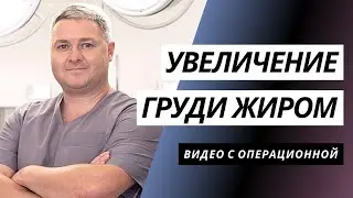 УВЕЛИЧЕНИЕ ГРУДИ СОБСТВЕННЫМ ЖИРОМ | ЛИПОФИЛИНГ ГРУДИ | УВЕЛИЧЕНИЕ ГРУДИ КИЕВ | МАММОПЛАСТИКА КИЕВ