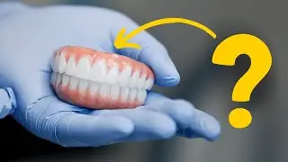 What Are Full Mouth Dental Implants?