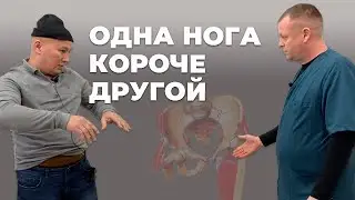 Одна нога короче другой | Костоправ Левых Владимир