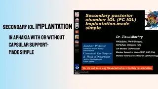 Secondary IOL Implantation made simple