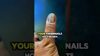 facts || what your fingernail hold secrets #facts #shorts #viralvideo