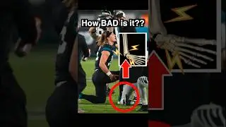 Doctor Explains: Trevor Lawrence AWKWARD ANKLE injury + Prognosis