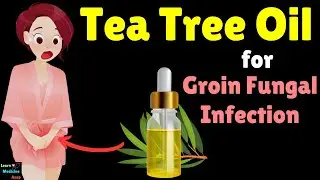 How to Use Tea Tree Oil for Jock Itch (Groin Fungal Infection)