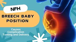 Breech pregnancy | Breech Baby | Signs and Symptoms of Breech Baby