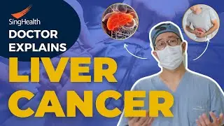 Doctor Explains Liver Cancer - Humans CANNOT Survive without a Liver!