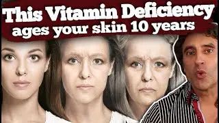 THIS ONE VITAMIN DEFICIENCY WRINKLING YOUR FACE // Vitamins for Skin