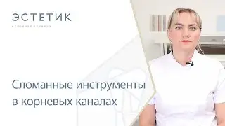 ⛏ Сломанные инструменты в корневых каналах зубов