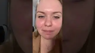 Привет, прыщ