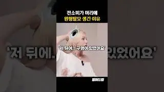 전소미가 머리에 원형탈모 생긴 이유