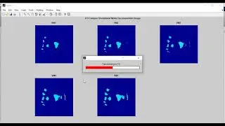 Automatic Classification of Glaucoma Stages from Fundus Images