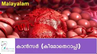 കാൻസർ (കീമോതെറാപ്പി) | Cancer (Chemotherapy) | Malayalam