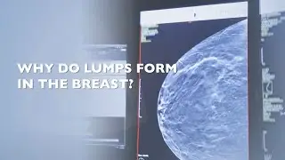 What To Do When You Find a Lump in Your Breast?