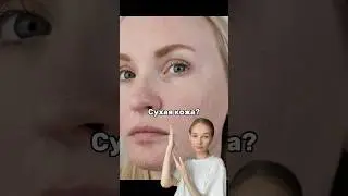 СУХАЯ кожа? ШЕЛУШЕНИЯ? Попробуй увлажняющий крем от VOIS (Wb: 154859676) 