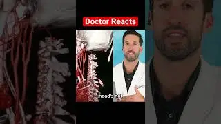 ER Doctor REACTS to Worlds Worst Backflip