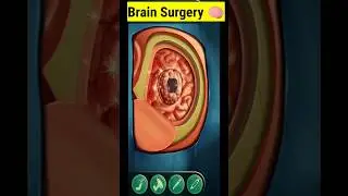 Brain Surgery 3D. 