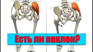 Иллюзия наклона таза.Как отличить вперед или назад?