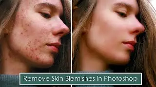 Easy Way to | Remove Skin Blemishes in Photoshop | Adobe Photoshop Tutorial. 