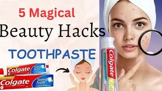 5 Magical Beauty HACKS Using TOOTHPASTE l Pimples,Dark Spots,Pink Lips, Blackheads Whiteheads l Tips