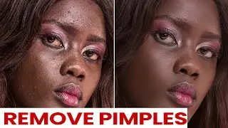 Get amazing skin textures in photoshop by removing pimples and blemishes Correctly. (2021)