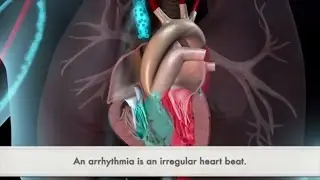 What Is An Arrhythmia? | Match Health