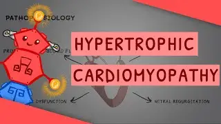 Hypertrophic Cardiomyopathy