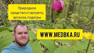 артрит, артроз, подагра