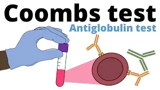 Coombs Test (antiglobulin test)