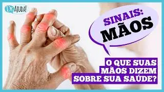 O que suas MÃOS podem dizer sobre sua SAÚDE 🤲 #mãos #artrite #artrose #dermatite