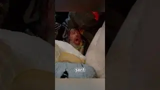 The homeless man ran into a trash can and was buried alive in the trash!