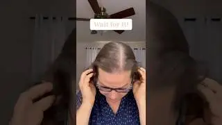 One Snap, Total Change! Hair Topper Before & After | UniWigs Savannah