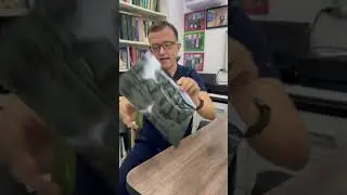 Пять грыж в позвоночнике.