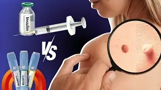 Ozempic vs Insulin: Which is More Effective for Diabetes?