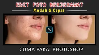 CARA MUDAH !! Edit foto menghilangkan jerawat pada wajah di photoshop