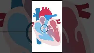 Evaluating Pulmonary Valve in TOF #shorts #echocardiography #ultrasound #pediatrics