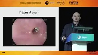 Рестентирование пищевода в лечении пищеводно-плеврального свища