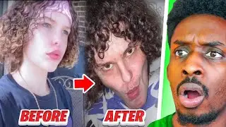 Gen Z Is Smashing Facial Bones to Look More Attractive| Dark side of Looksmaxxing