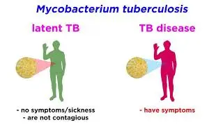 Multidrug-Resistant Tuberculosis (MDR-TB): Mycobacterium tuberculosis