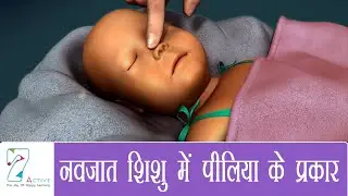 नवजात शिशु में पीलिया के प्रकार | Types of Jaundice in Newborn | Hindi