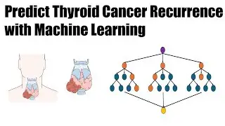 Predict Thyroid Cancer Recurrence with Machine Learning: A Coding Tutorial